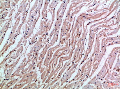 Anti-MIA Rabbit Polyclonal Antibody