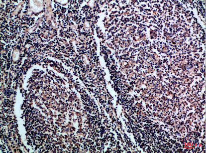 Anti-CD1a/b Rabbit Polyclonal Antibody