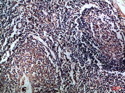 Anti-CD1a/b Rabbit Polyclonal Antibody