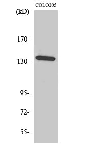 Anti-ALPK1 Rabbit Polyclonal Antibody