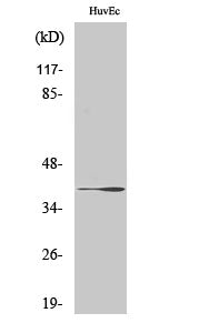Anti-beta 3 Gal T1 Rabbit Polyclonal Antibody