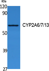 Anti-Cytochrome P450 2A6/7/13 Rabbit Polyclonal Antibody