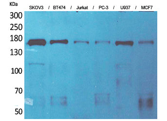 Anti-Synaptonemal Complex Protein 2 Rabbit Polyclonal Antibody