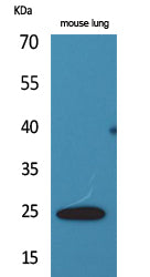 Anti-Endothelin 1 Rabbit Polyclonal Antibody