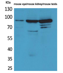 Anti-HGS Rabbit Polyclonal Antibody