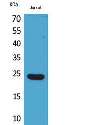Anti-Interferon epsilon Rabbit Polyclonal Antibody