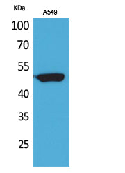 Anti-FOXA Rabbit Polyclonal Antibody