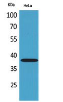 Anti-KIR2DL2/3 Rabbit Polyclonal Antibody