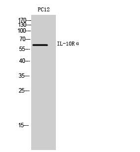 Anti-IL-10 Receptor alpha Rabbit Polyclonal Antibody