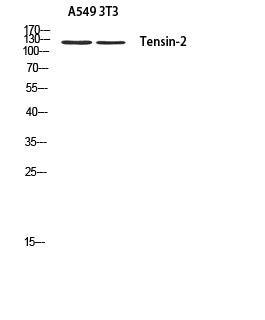 Anti-Tensin 2 Rabbit Polyclonal Antibody