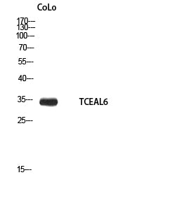 Anti-TCEAL6 Rabbit Polyclonal Antibody