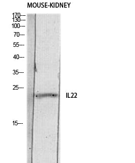 Anti-IL-22 Rabbit Polyclonal Antibody