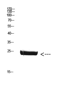 Anti-Placental Lactogen Rabbit Polyclonal Antibody