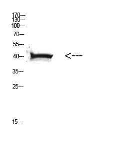 Anti-HLA A Rabbit Polyclonal Antibody
