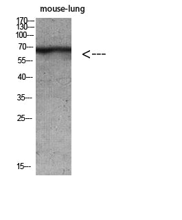 Anti-Cytokeratin Rabbit Polyclonal Antibody