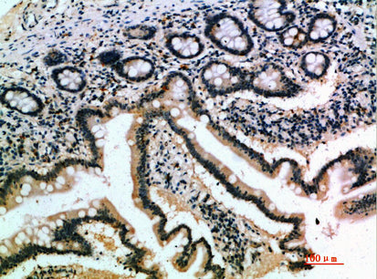Anti-IL-17B Rabbit Polyclonal Antibody