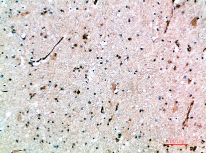 Anti-AVPR1B Rabbit Polyclonal Antibody