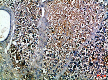 Anti-Insulin Rabbit Polyclonal Antibody