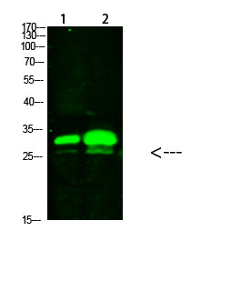 Anti-KCTD7 Rabbit Polyclonal Antibody