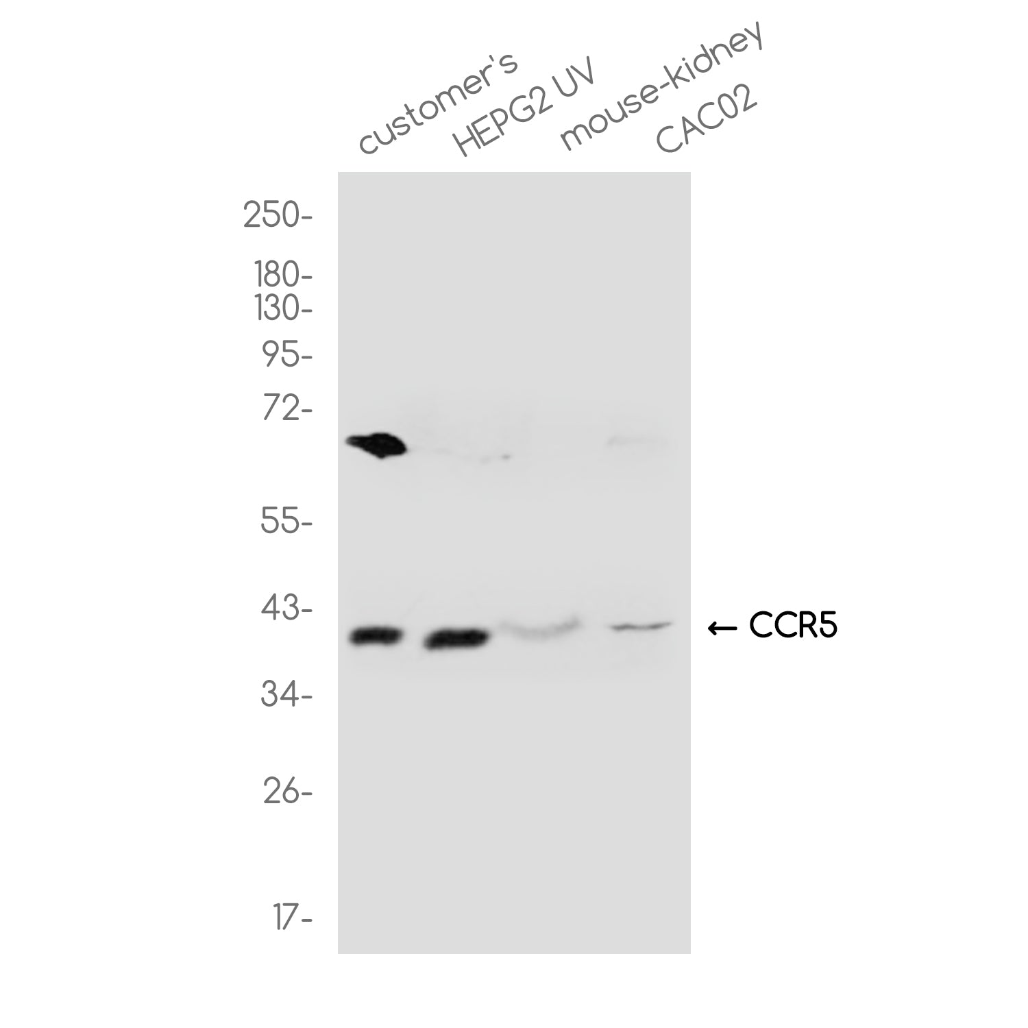 Anti-CCR5 Rabbit Polyclonal Antibody