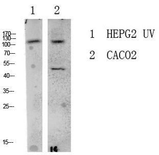 Anti-LATS1 Rabbit Polyclonal Antibody