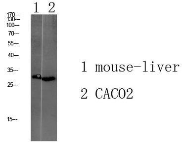 Anti-Transmembrane Protein 72 Rabbit Polyclonal Antibody
