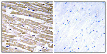 Anti-B3GALT2 Rabbit Polyclonal Antibody
