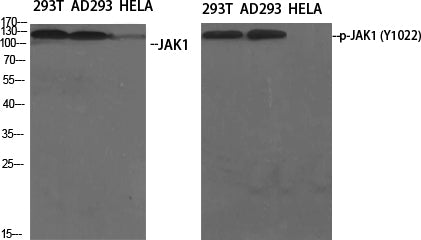 Anti-Phospho-JAK1 (Tyr1022) Rabbit Polyclonal Antibody