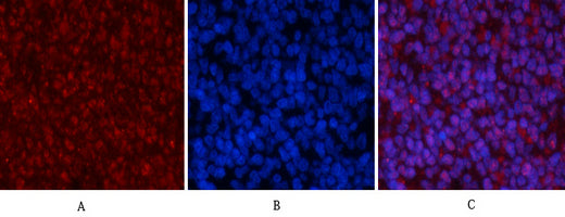 Anti-Phospho-p53 (Ser15) Rabbit Polyclonal Antibody