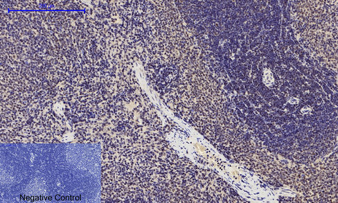 Anti-Phospho-p53 (Ser15) Rabbit Polyclonal Antibody