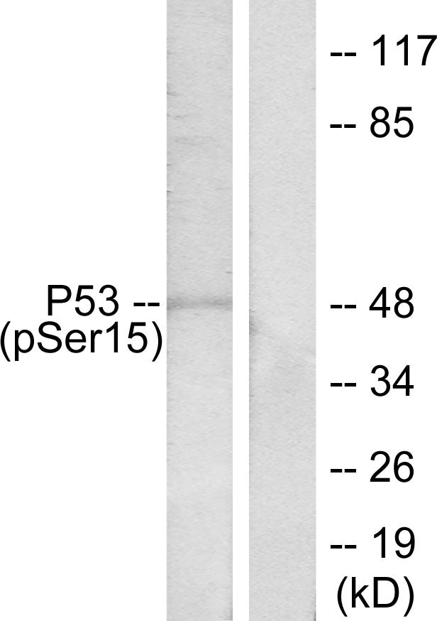 Anti-Phospho-p53 (Ser15) Rabbit Polyclonal Antibody