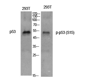 Anti-Phospho-p53 (Ser15) Rabbit Polyclonal Antibody