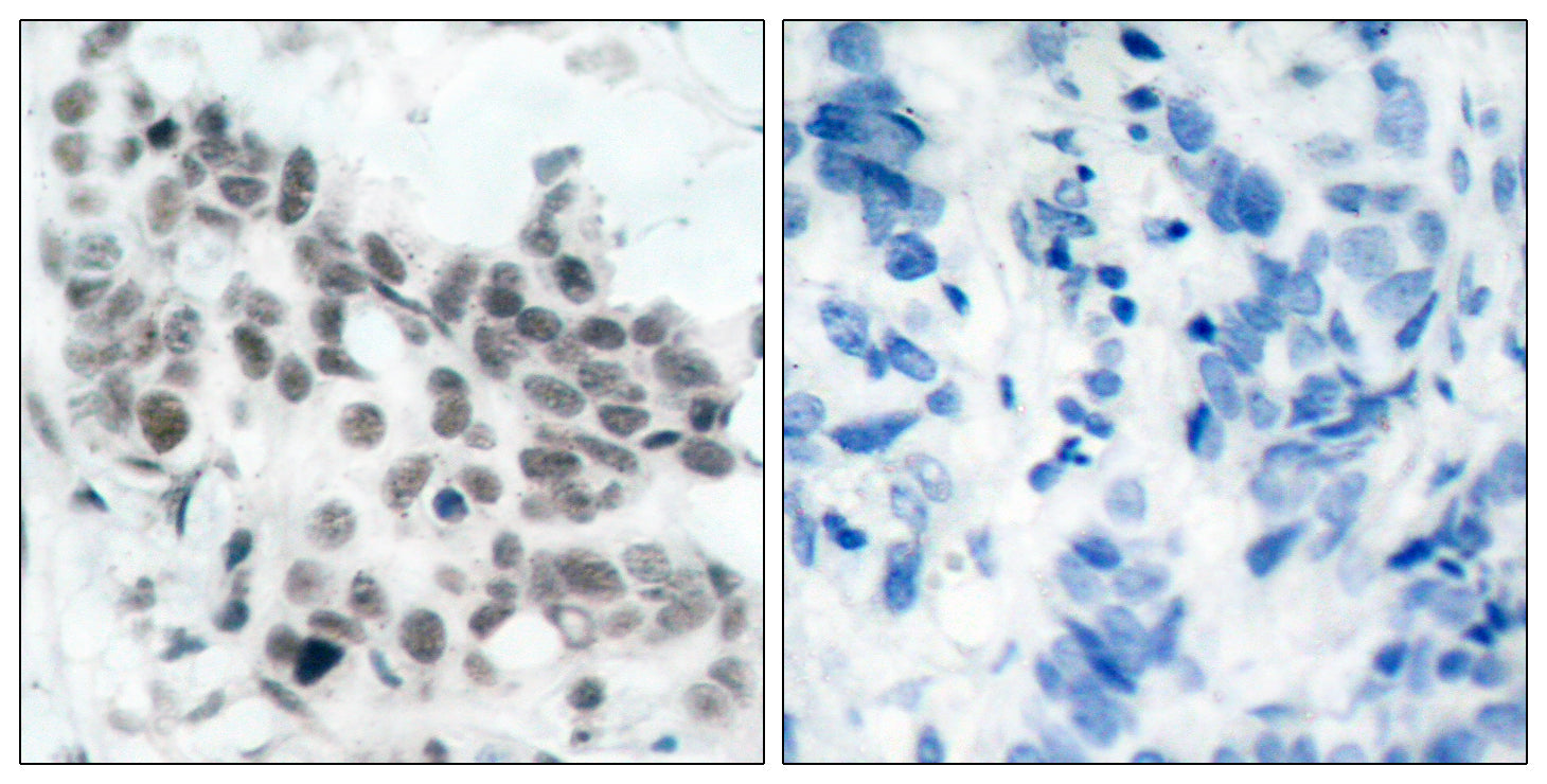 Anti-Phospho-Rb (Ser780) Rabbit Polyclonal Antibody