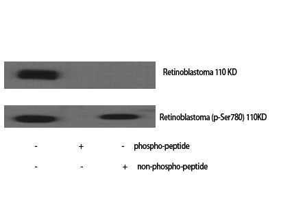 Anti-Phospho-Rb (Ser780) Rabbit Polyclonal Antibody