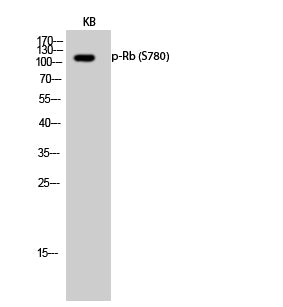 Anti-Phospho-Rb (Ser780) Rabbit Polyclonal Antibody