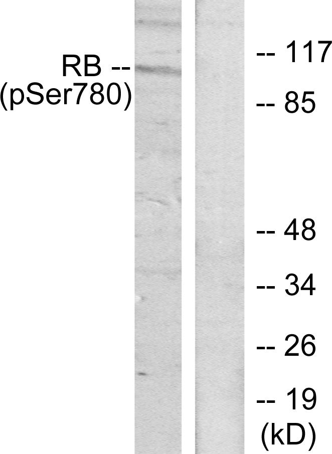 Anti-Phospho-Rb (Ser780) Rabbit Polyclonal Antibody