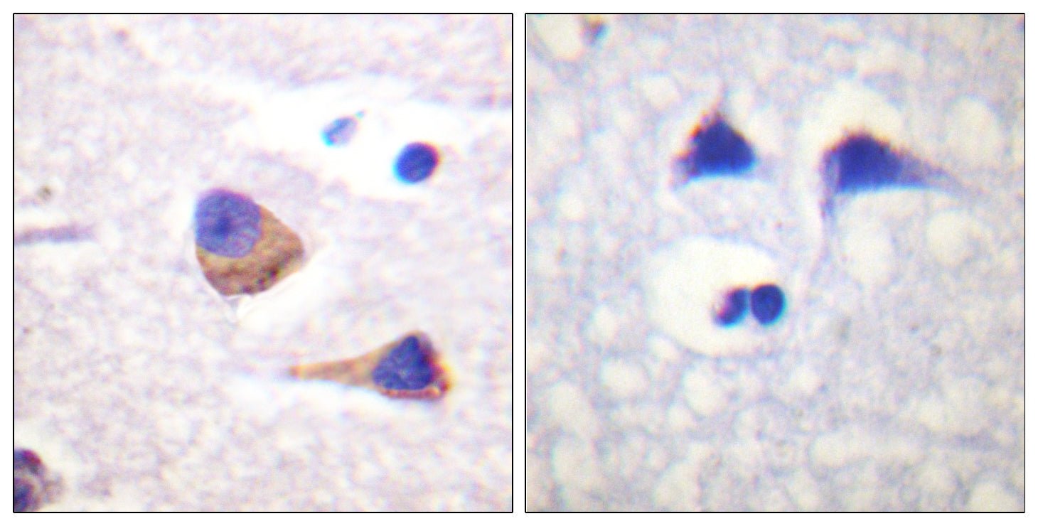 Anti-Phospho-JAK3 (Tyr785) Rabbit Polyclonal Antibody