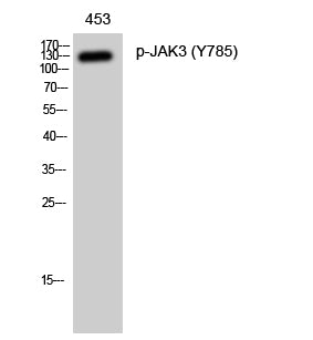 Anti-Phospho-JAK3 (Tyr785) Rabbit Polyclonal Antibody