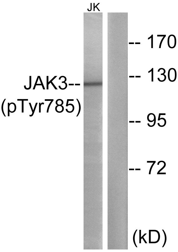 Anti-Phospho-JAK3 (Tyr785) Rabbit Polyclonal Antibody