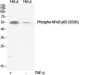 Anti-Phospho-NF-KB p65 (Ser536) Rabbit Polyclonal Antibody