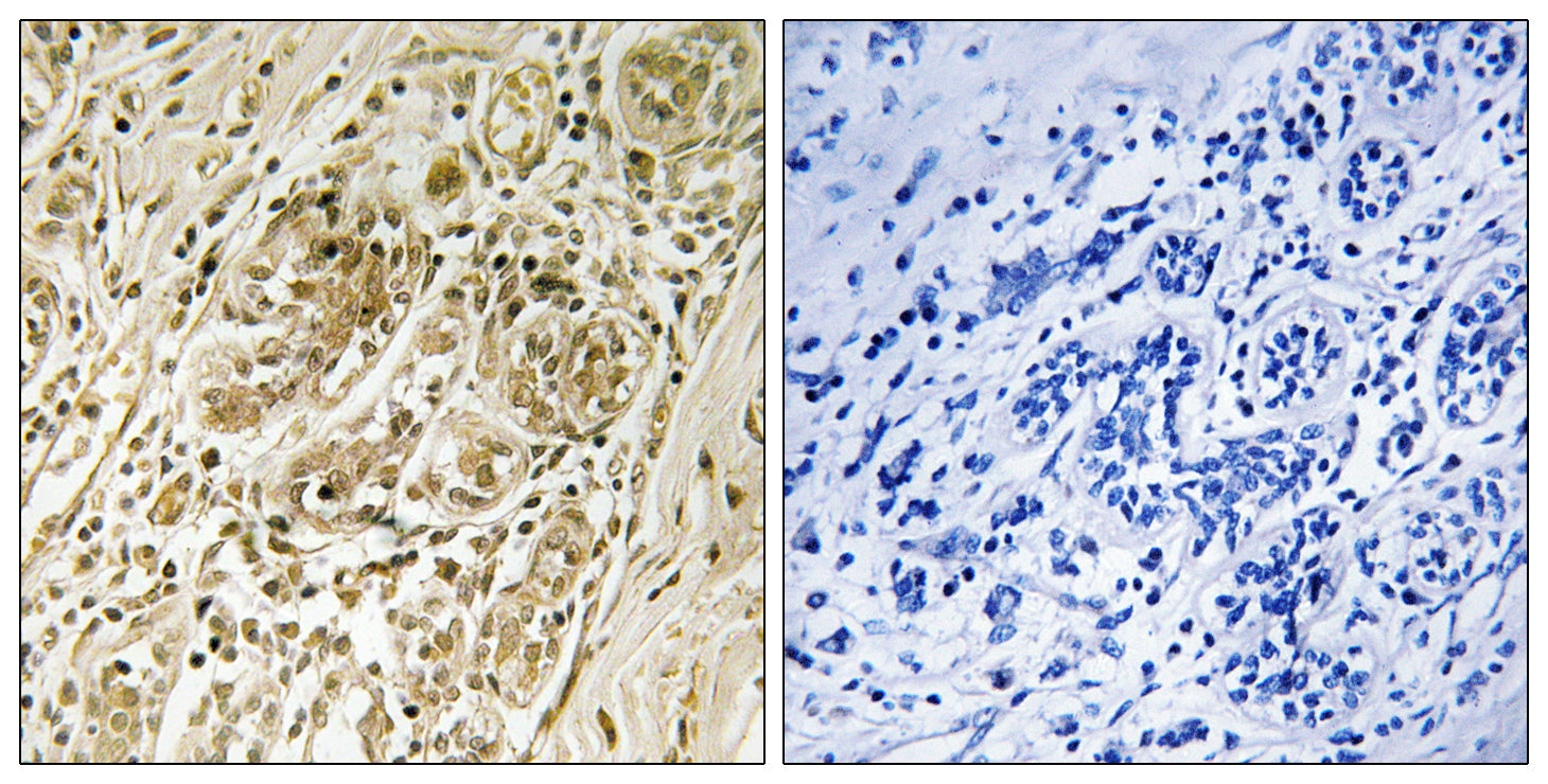 Anti-Phospho-IRS1 (Ser639) Rabbit Polyclonal Antibody