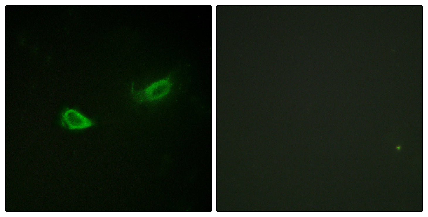 Anti-Phospho-alpha 1 Sodium Potassium ATPase (Ser23) Rabbit Polyclonal Antibody