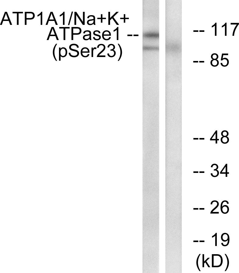 Anti-Phospho-alpha 1 Sodium Potassium ATPase (Ser23) Rabbit Polyclonal Antibody