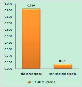Anti-Phospho-Cardiac Troponin I (Ser22/Ser23) Rabbit Polyclonal Antibody