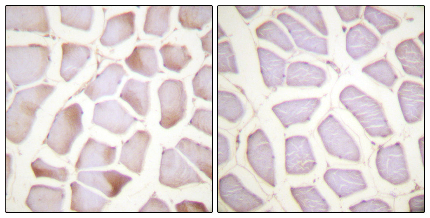 Anti-Phospho-Cardiac Troponin I (Ser22/Ser23) Rabbit Polyclonal Antibody