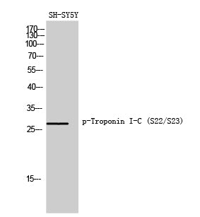 Anti-Phospho-Cardiac Troponin I (Ser22/Ser23) Rabbit Polyclonal Antibody