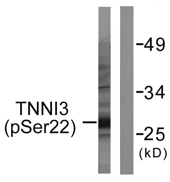 Anti-Phospho-Cardiac Troponin I (Ser22/Ser23) Rabbit Polyclonal Antibody