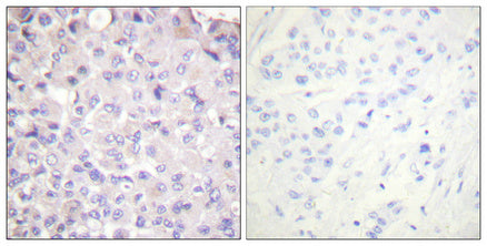 Anti-Phospho-IKK beta (Tyr188) Rabbit Polyclonal Antibody