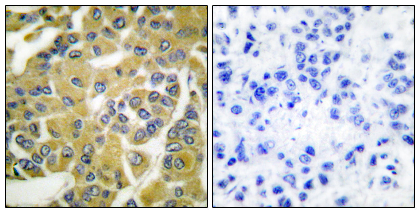 Anti-Phospho-IKK beta (Tyr188) Rabbit Polyclonal Antibody