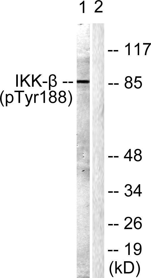 Anti-Phospho-IKK beta (Tyr188) Rabbit Polyclonal Antibody
